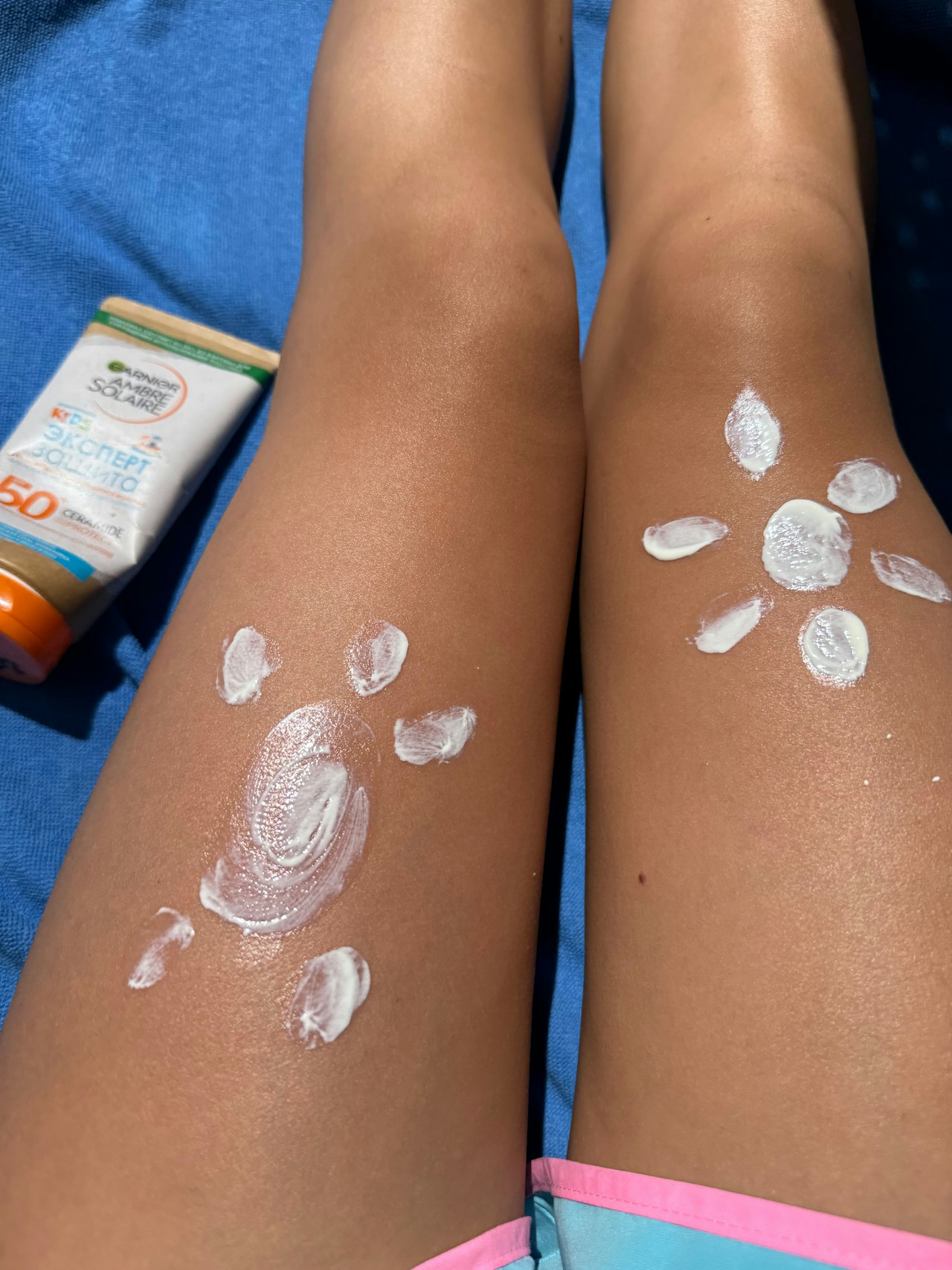 coup de soleil
